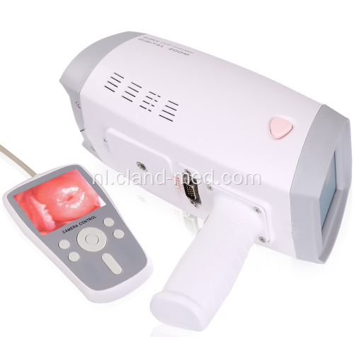 Handheld digitale Full hd-camera voor vagina-colposcoop